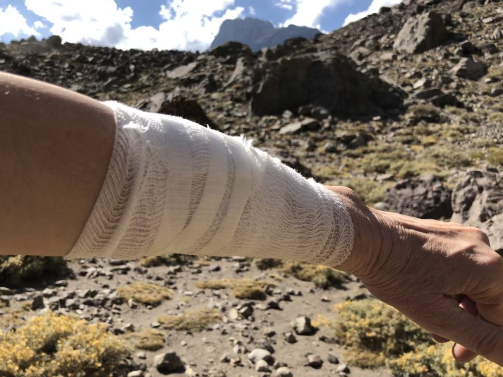 Close-up of arm wrapped in a bandage during Andes hike near Santiago – challenges on 4 days in Santiago adventure.